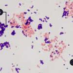 gram stain procedure- gram staining steps