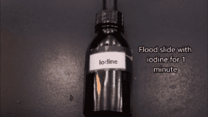 Gram stain procedure - add grams iodine