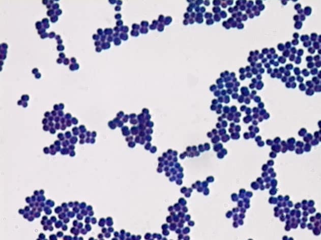 Picture of gram positive bacteria under microscope